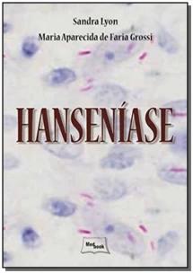 Hanseníase