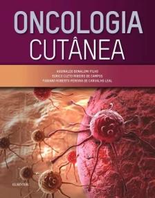 Oncologia Cutânea