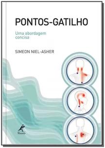 Pontos-gatilho